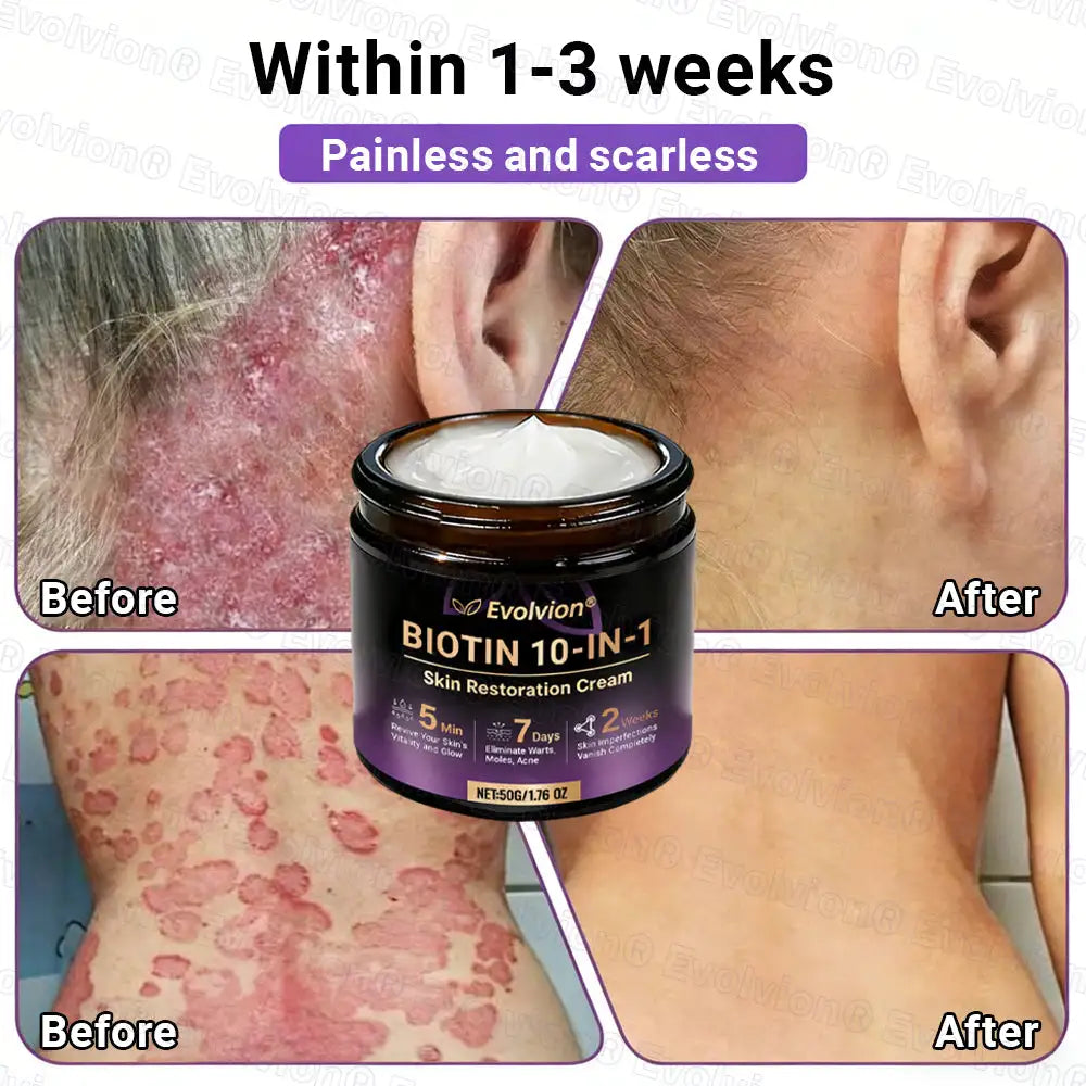 Evolvion® Biotin 10-in-1 Skin Restoration Cream (Pack of 2 | 500g x 2)
