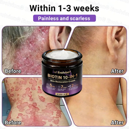 Evolvion® Biotin 10-in-1 Skin Restoration Cream (Pack of 2 | 500g x 2)
