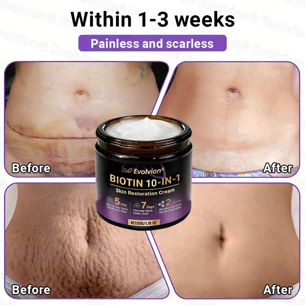 Evolvion® Biotin 10-in-1 Skin Restoration Cream (Pack of 2 | 500g x 2)