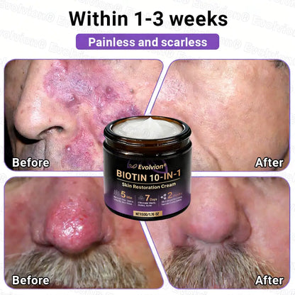Evolvion® Biotin 10-in-1 Skin Restoration Cream (Pack of 2 | 500g x 2)